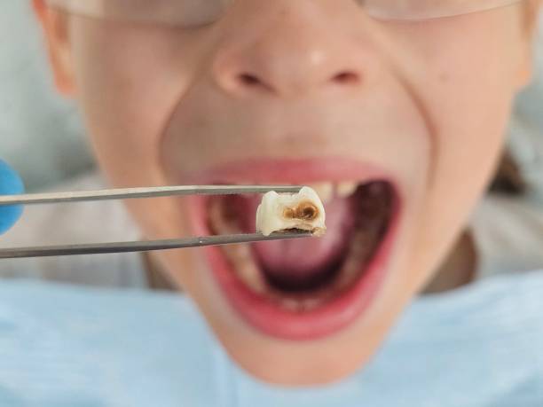 Best Cosmetic Emergency Dentistry in Monroe, MI